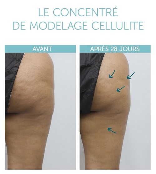 Concentré Modelage Cellulite 3